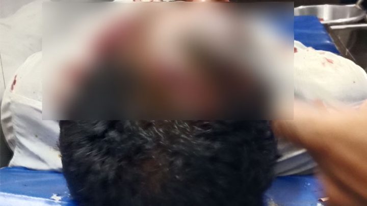 ইবি কর্মকর্তার সঙ্গে হাতাহাতি, আহত ভ্যানচালক