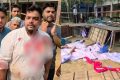 রূপগঞ্জে এনসিপির অনুষ্ঠানে ছাত্রদলের হামলার অভিযোগ