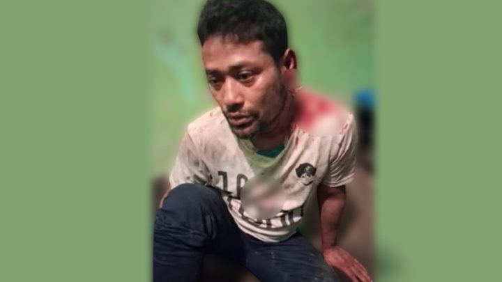 শিশুকে যৌন হয়রানির অভিযোগে অটোরিকশাচালক কারাগারে